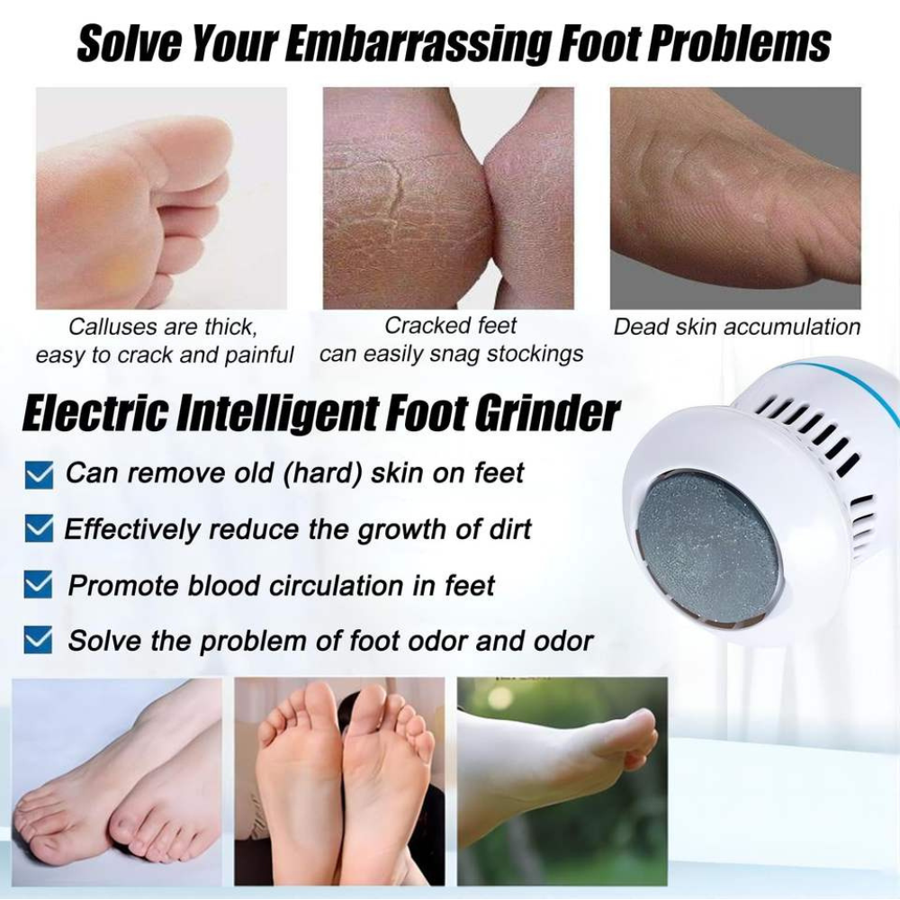 electric dead skin remover price in pakistan

foot callus remover Pakistan price in pakistan


electric foot file rechargeable price in pakistan


Buy cracked heel remover tool price in pakistan


buy pedicure machine for feet price in pakistan


heel hard skin remover

dead skin remover device