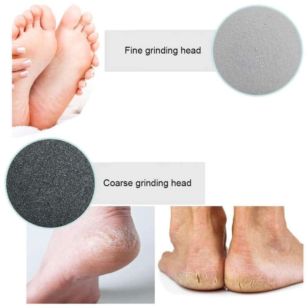 electric dead skin remover price in pakistan

foot callus remover Pakistan price in pakistan


electric foot file rechargeable price in pakistan


Buy cracked heel remover tool price in pakistan


buy pedicure machine for feet price in pakistan


heel hard skin remover

dead skin remover device
