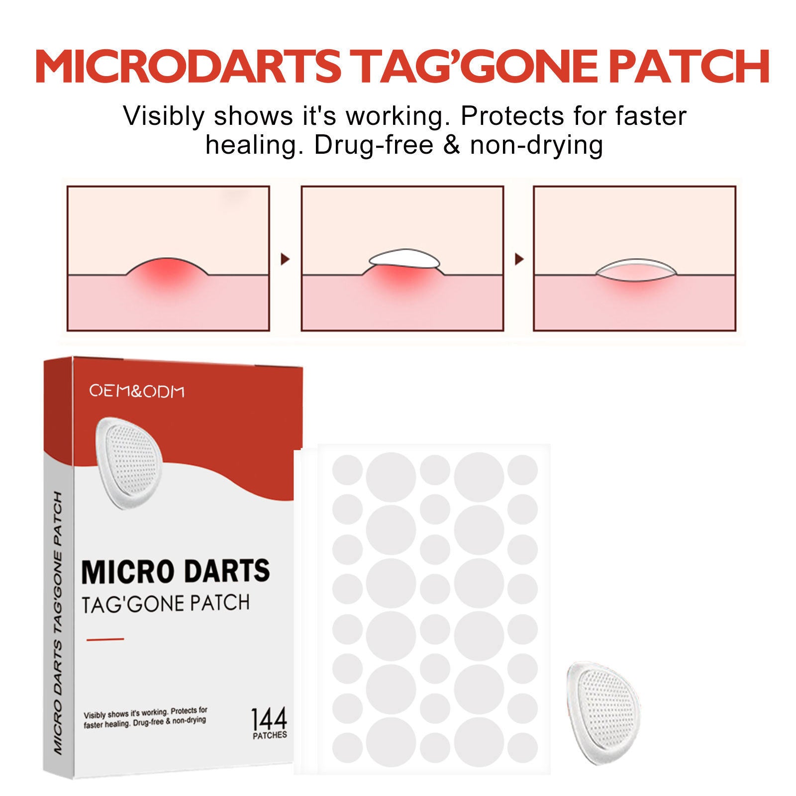 Acne Pimple Patches Hydrocolloid Spot Treatment