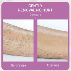 Painless Crystal Hair Remover – Reusable Full Body Epilator for Smooth Skin (Women & Men)
