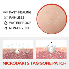 Acne Pimple Patches Hydrocolloid Spot Treatment