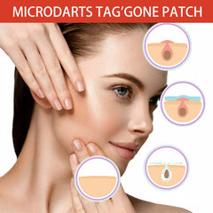 Acne Pimple Patches Hydrocolloid Spot Treatment