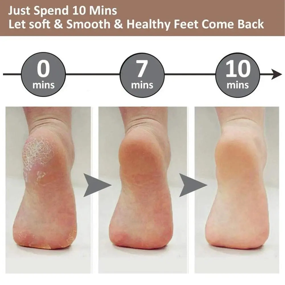 Electric Foot Filer | Callus Remover