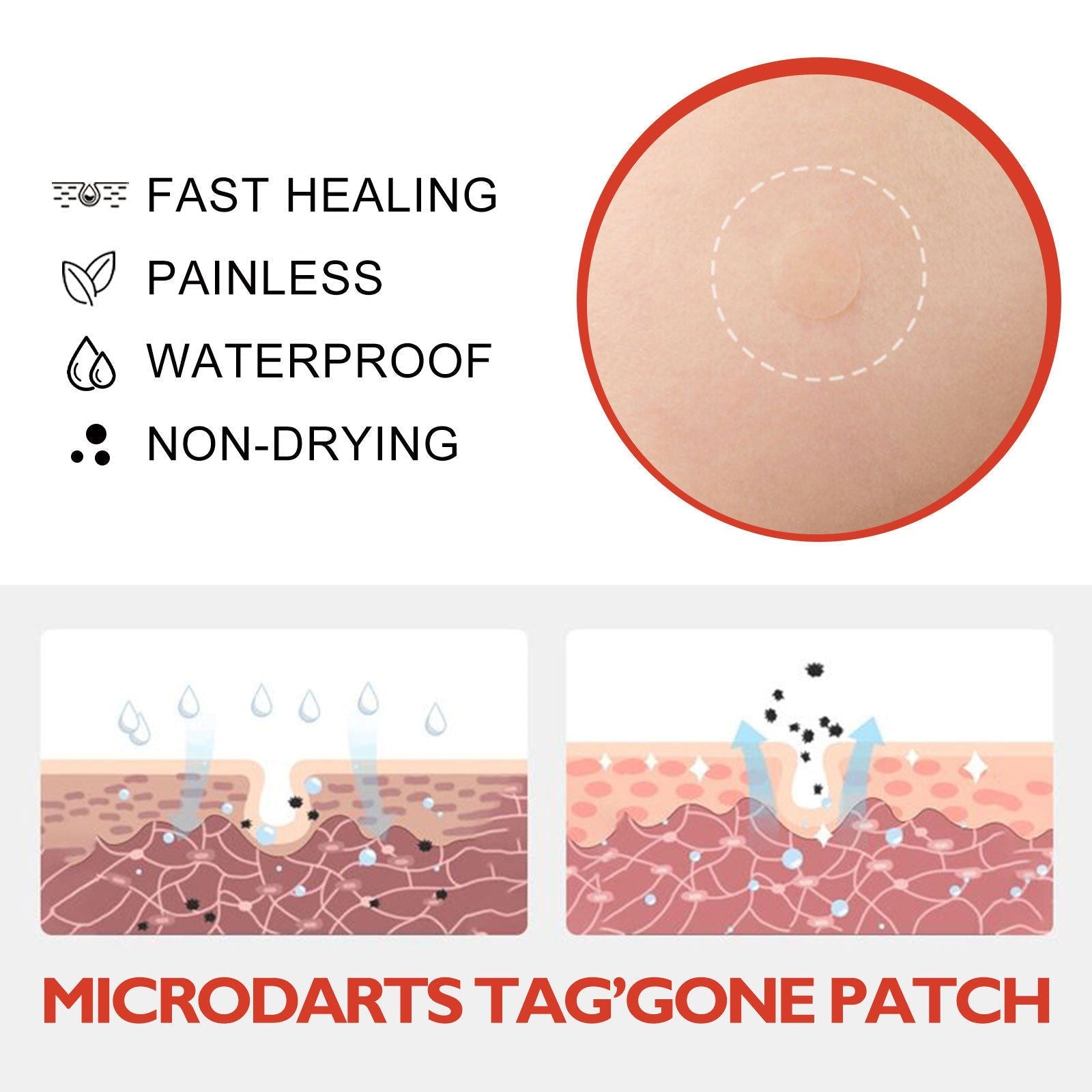Acne Pimple Patches Hydrocolloid Spot Treatment - Aarvana