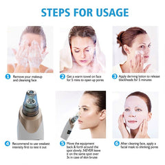 Blackhead Remover – Deep Pore Cleaner Vacuum | Electric Acne & Whitehead Removal Device (3 Modes, 4 Heads) - Aarvana